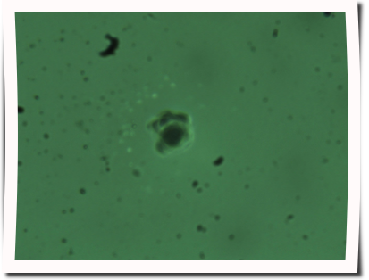 KieferpollenW&uuml;So